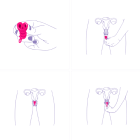 Coupe menstruelle pliable Lily Cup One pour débutantes